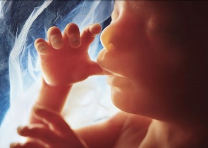 fetal_20_week_fetus_s7a